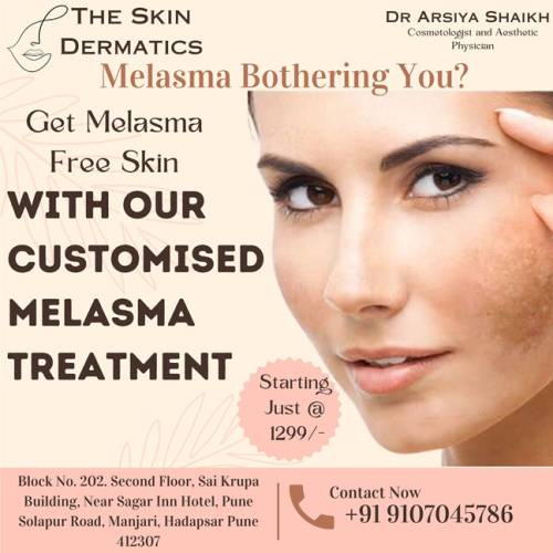 MELASMA TREATMENT – The Skin Care & Dermatics